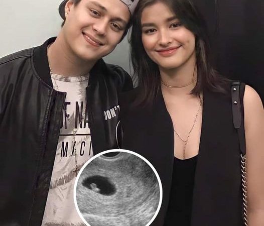 Liza Soberano Shocks Fans with Pregnancy Announcement Right After Surprise Marriage!